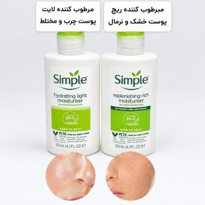 آبرسان سیمپل